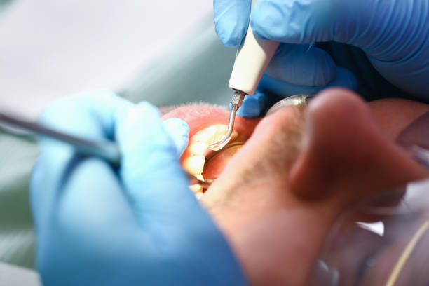Best Emergency Dental Services for Seniors in Hamlet, NC