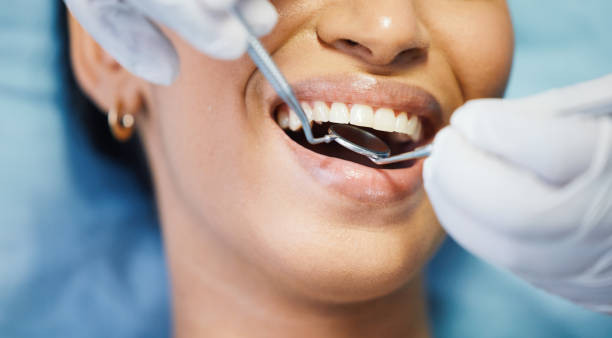 Best Emergency Dental Extractions in Hamlet, NC