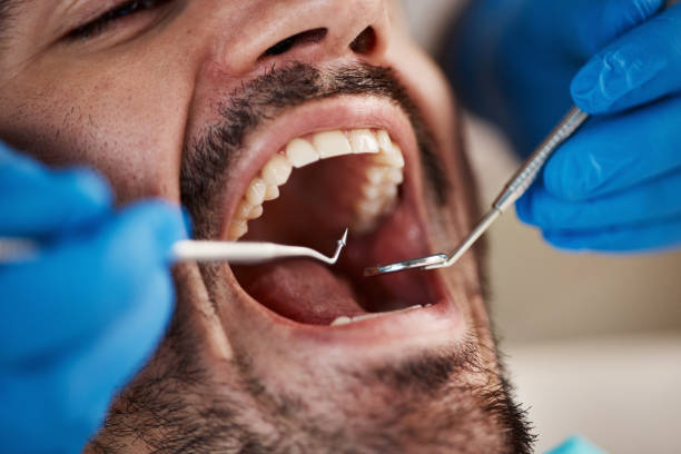 Best Emergency Dentist for Knocked-Out Tooth in Hamlet, NC